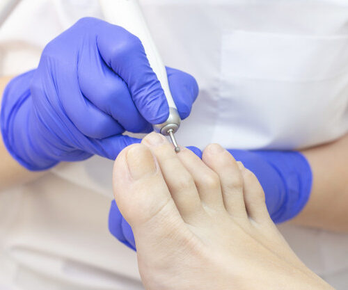 Therapeutic pedicure. Master podologist does hardware pedicure. visit to the podiatry. Foot treatment in the spa. Clinic of Podiatria.